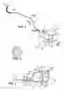 Fig. 02 - Skin expansion system