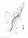 Fig. 09 - Knotless suture anchor with unthreaded nose