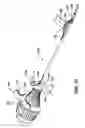 Fig. 10 - Knotless suture anchor with unthreaded nose