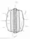 Fig. 01 - Dual inflatable arterial prosthesis
