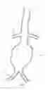 Fig. 04 - Dual inflatable arterial prosthesis