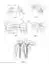 Fig. 02 - Orthopaedic device for correction of deformities in a bone