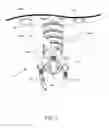 Fig. 08 - SURGICAL TOOL POSITIONING SYSTEM