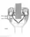 Fig. 08 - Cannula sealing