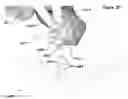 Fig. 45 - Clamping device for use with an anatomic external fixation device