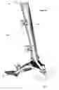 Fig. 49 - Clamping device for use with an anatomic external fixation device