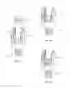 Fig. 07 - Spinal implant system and methods of use