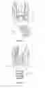 Fig. 09 - Spinal implant system and methods of use