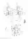 Fig. 07 - Rib reconstruction device
