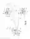 Fig. 08 - Rib reconstruction device