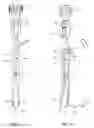 Fig. 07 - Surgical instrument and method
