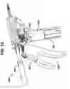 Fig. 08 - Methods and devices for controlling motorized surgical devices