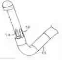 Fig. 01 - Method and device for uterine fibroid treatment