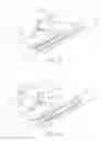 Fig. 05 - Method and device for uterine fibroid treatment