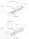 Fig. 07 - Method and device for uterine fibroid treatment
