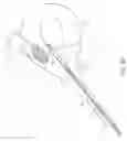 Fig. 09 - Method and device for uterine fibroid treatment
