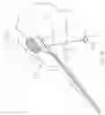 Fig. 10 - Method and device for uterine fibroid treatment
