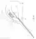 Fig. 16 - Method and device for uterine fibroid treatment