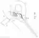 Fig. 24 - Method and device for uterine fibroid treatment