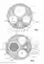 Fig. 03 - Laser Applicator Having Electrodes