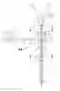Fig. 01 - Suction lithotripsy apparatus, method and kit
