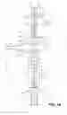 Fig. 03 - Suction lithotripsy apparatus, method and kit