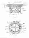 Fig. 02 - Heart valve assembly
