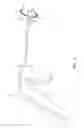 Fig. 03 - Adjustable annuloplasty ring replica sizer