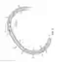 Fig. 05 - Adjustable annuloplasty ring replica sizer