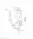 Fig. 08 - Adjustable annuloplasty ring replica sizer