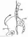 Fig. 01 - Sacroiliac joint immobilization