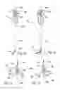 Fig. 07 - Instrument for inserting a spinal implant and a spinal implant