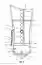 Fig. 04 - Modular Prosthetic Sockets and Method for Making Same