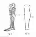 Fig. 16 - Modular Prosthetic Sockets and Method for Making Same