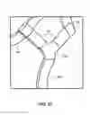Fig. 17 - Modular Prosthetic Sockets and Method for Making Same