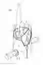 Fig. 02 - Stent graft with internal constraining mechanism