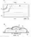 Fig. 07 - Perineal thermal pack with improved liquid containment