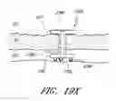 Fig. 49 - IMPLANTS WITH CONTROLLED DRUG DELIVERY FEATURES AND METHODS OF USING SAME