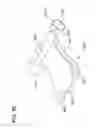 Fig. 49 - Packaged body adhering absorbent article