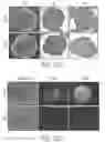 Fig. 35 - DYE-STABILIZED NANOPARTICLES AND METHODS OF THEIR MANUFACTURE AND THERAPEUTIC USE
