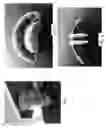 Fig. 02 - Oral Devices and Methods of Making