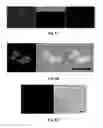 Fig. 11 - Aminoglycoside hydrogel microbeads and macroporous gels with chemical crosslink, method of preparation and use thereof