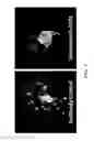Fig. 22 - System and method for a biomimetic fluid processing