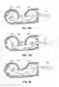 Fig. 83 - HUMANOID ROBOTICS SYSTEM AND METHODS