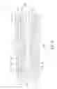 Fig. 04 - KNIFE CONFIGURED TO RECEIVE BLADE SECURELY AND SAFELY