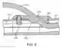 Fig. 06 - BICYCLE CARRIER LOCKING ASSEMBLY