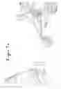 Fig. 09 - System for transporting child stroller