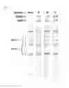 Fig. 14 - METHOD FOR PREPARING SINGLE-STRANDED DNA PRODUCT