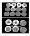 Fig. 09 - ANTIMICROBIAL FIBERS AND COMPOSITIONS