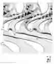 Fig. 02 - Blade with parallel corrugated surfaces on inner and outer surfaces